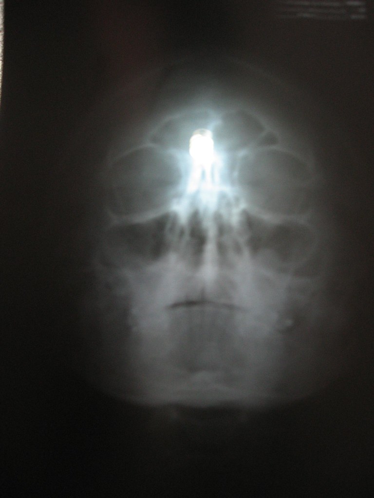 xray of my face